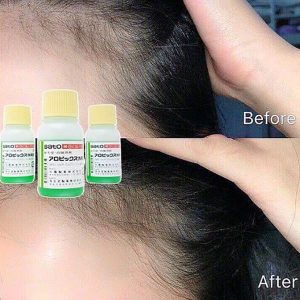 Tinh Chất Kích Mọc Tóc Sato Arovics Solutions 5% nuôi dưỡng nang tóc