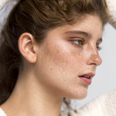 Cây thuốc trị nám nặng