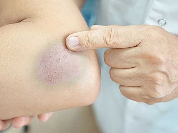 Da bị bầm tím dù va chạm nhẹ là dấu hiệu bệnh ung thư nguy hiểm
